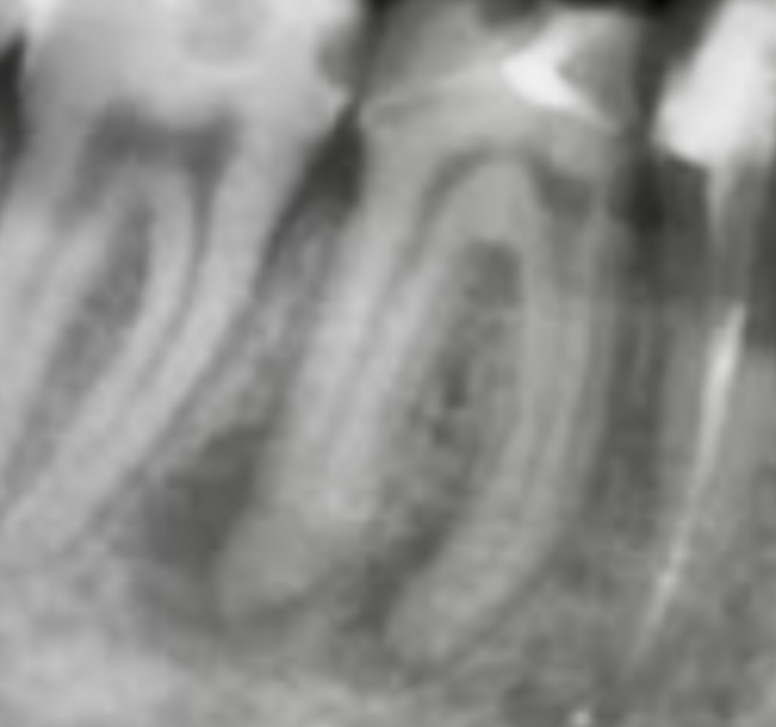 image before