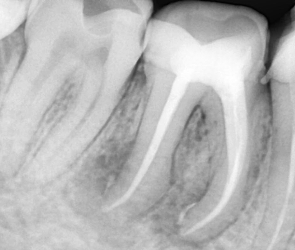 image after